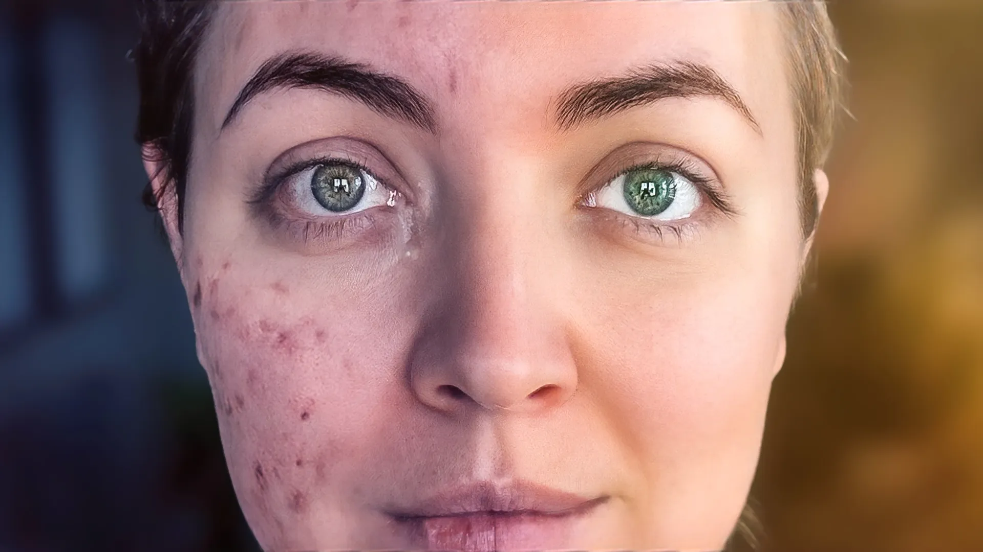 How I Went From Constant Breakouts to Clear Skin (My Skincare ...
