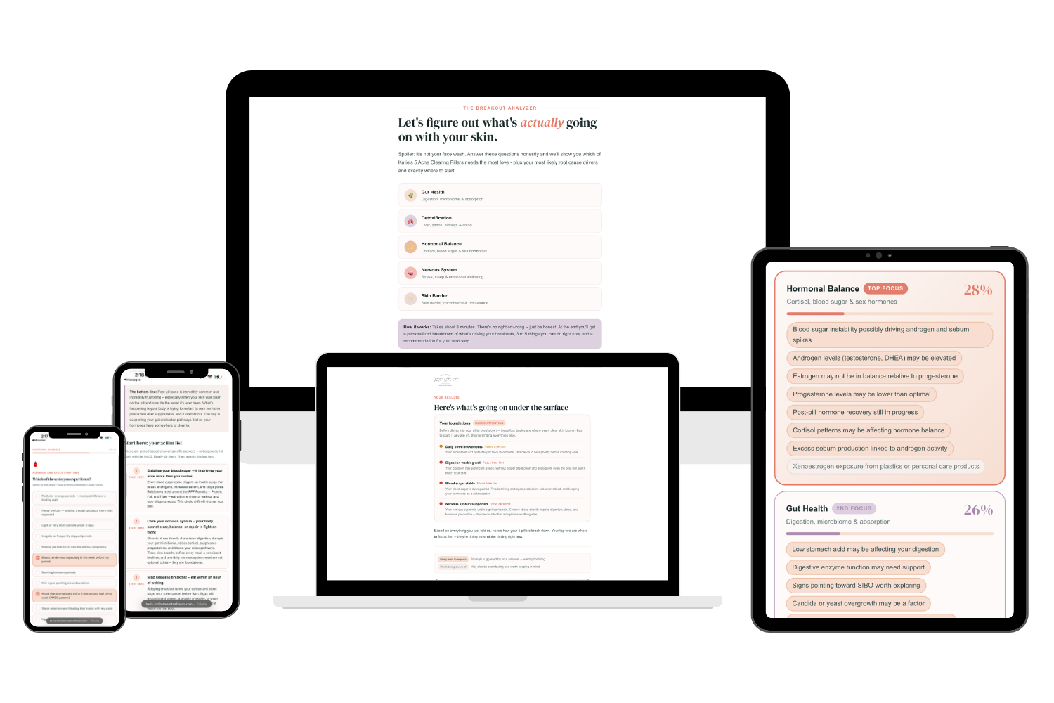 The Breakout Analyzer tool preview