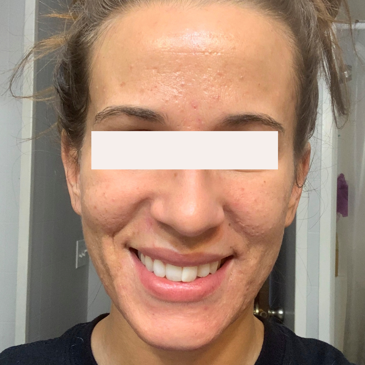 Lauren after