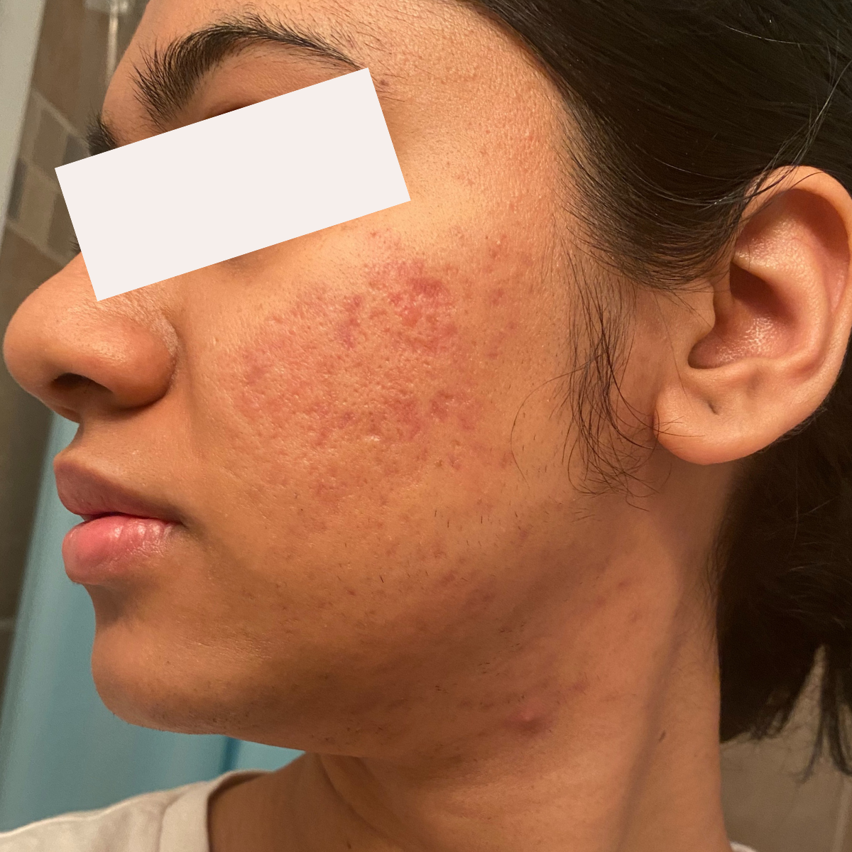 Meghana M. after