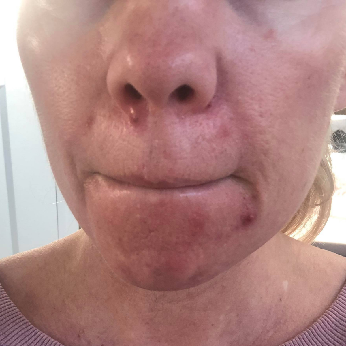 Mandy before