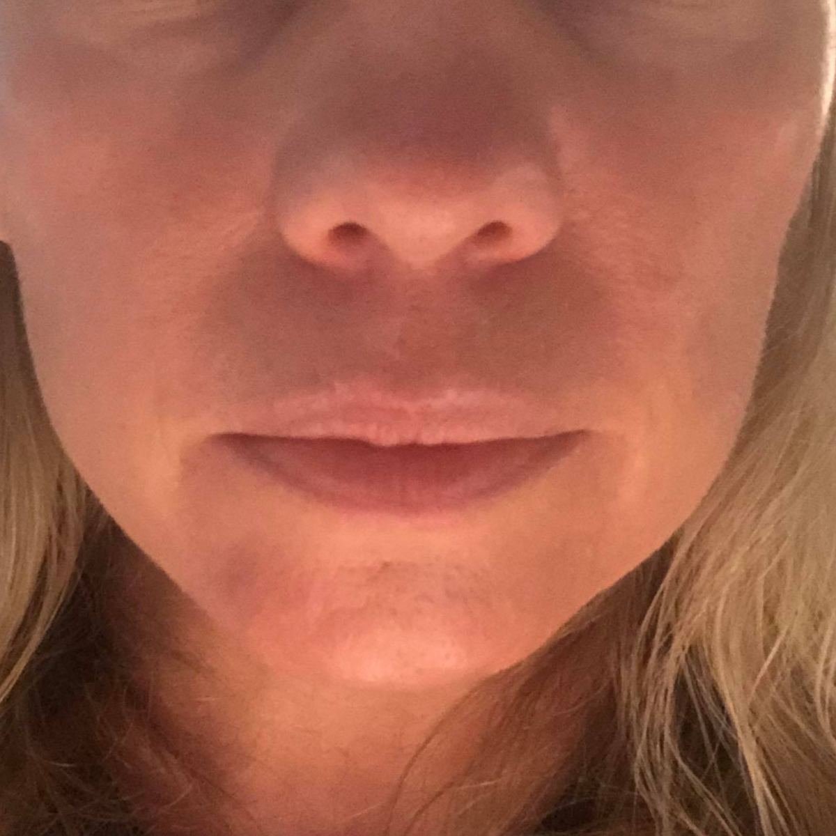 Mandy after