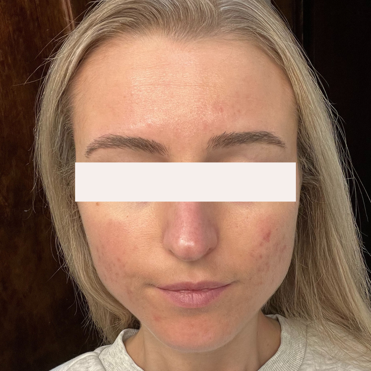 Samantha K. after